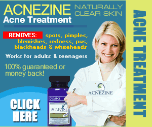 Acnezine the most effective acne treatment cream