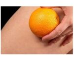 8 Natural Ways To Get Rid Of Cellulite
